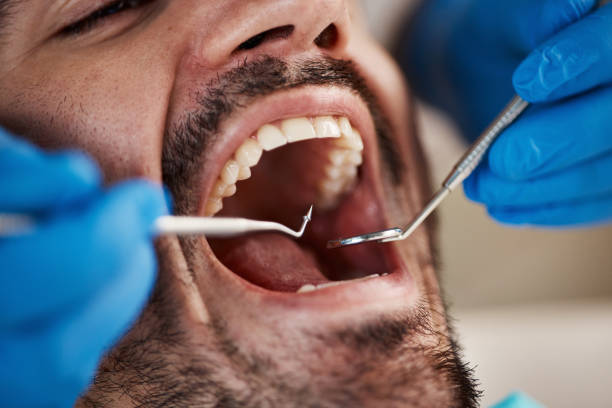 Best Emergency Treatment for Toothache in Mapleton, ND