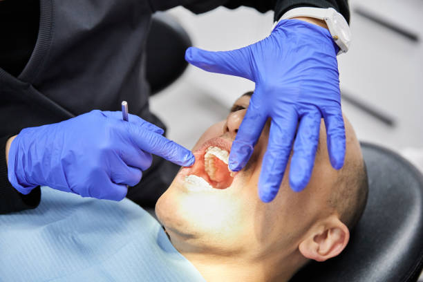 Best Emergency Dental Surgery in Mapleton, ND