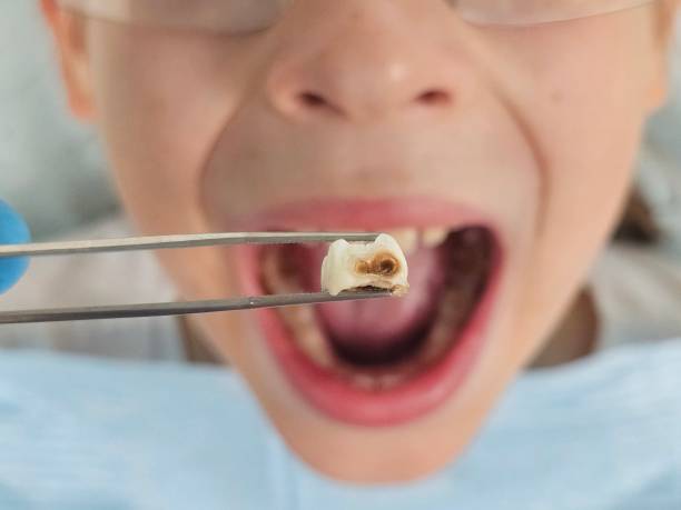 Best Same-Day Emergency Dentist in Mapleton, ND